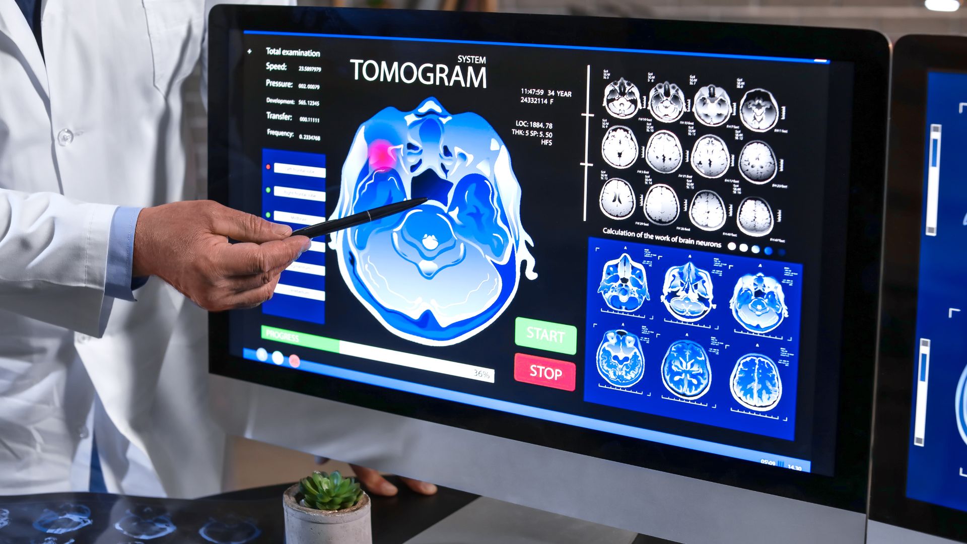 Neurologist serving Midland, MI patients at Michigan Advanced Neurology Center in nearby Saginaw